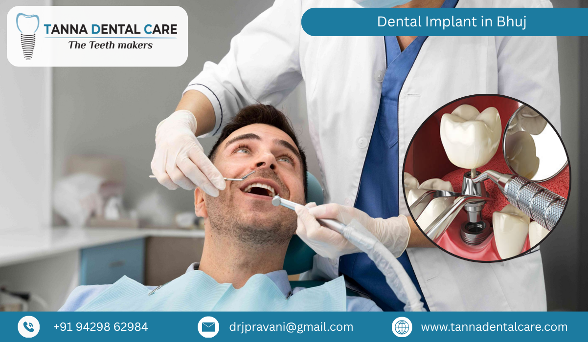 Dental Implant in Bhuj 