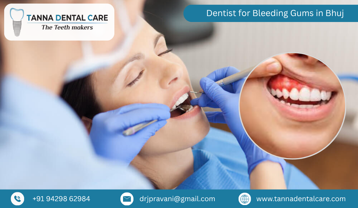 Dentist for Bleeding Gums in Bhuj