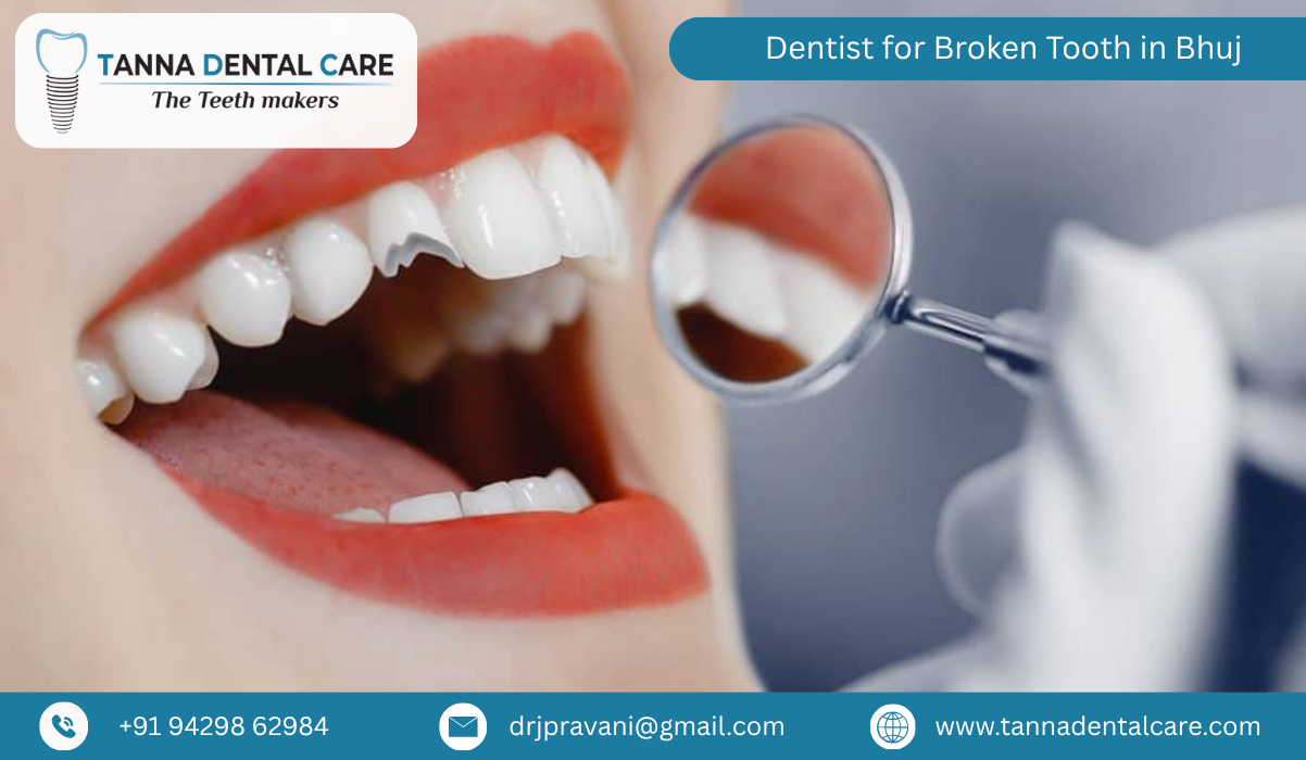 Dentist for Broken Tooth in Bhuj