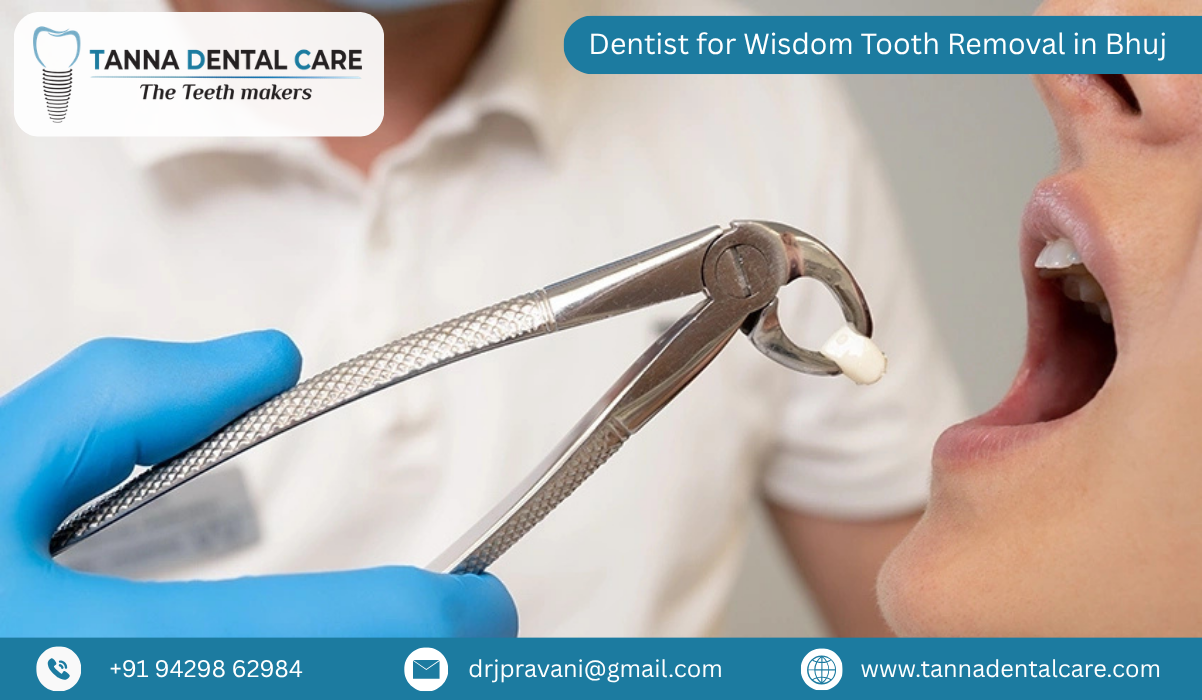 Dentist for Wisdom Tooth Removal in Bhuj