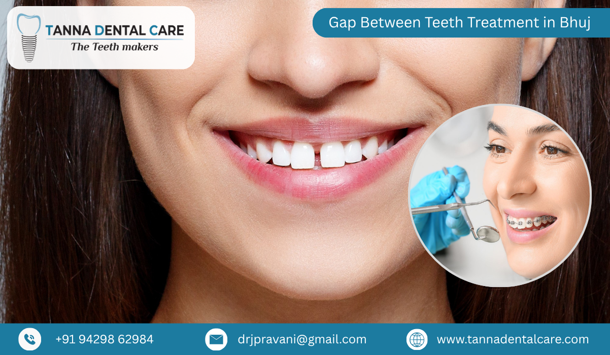 Gap Between Teeth Treatment in Bhuj