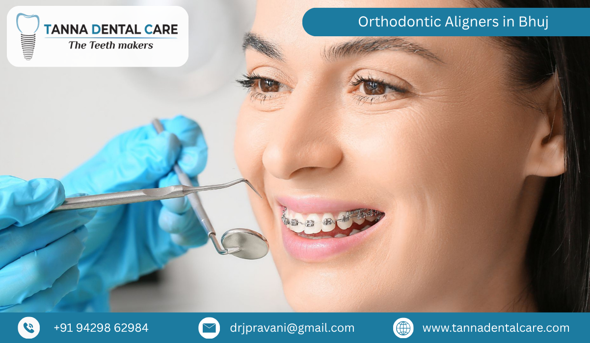 Orthodontic Aligners in Bhuj