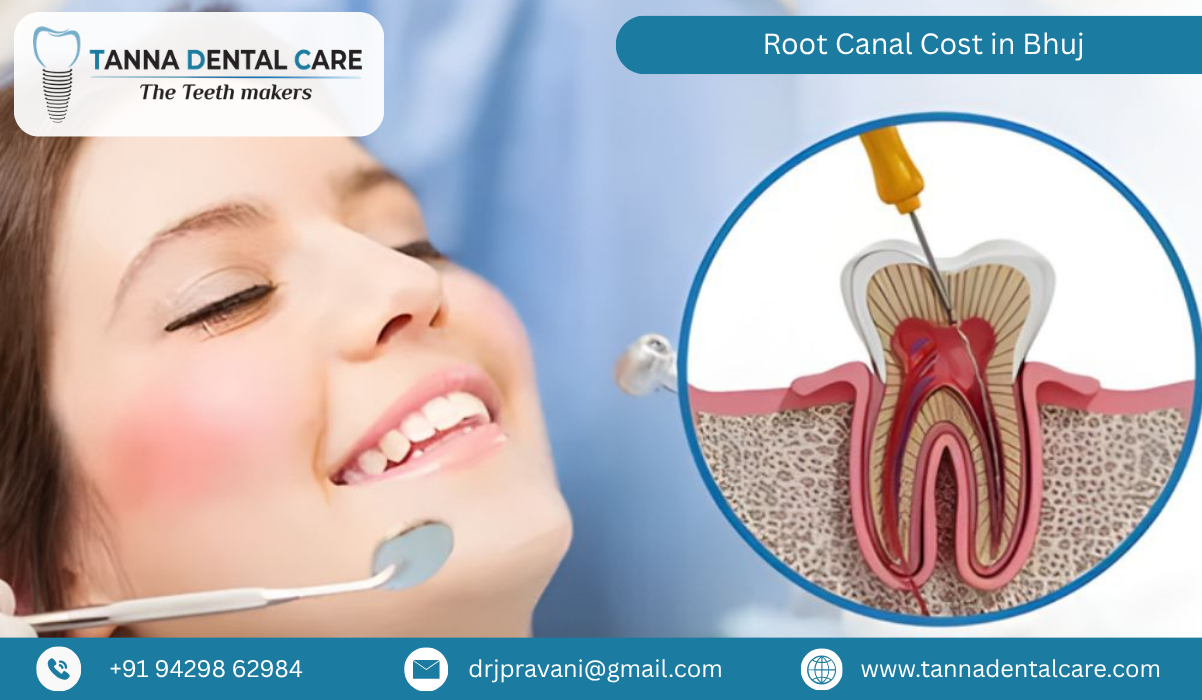 Root Canal Cost in Bhuj 