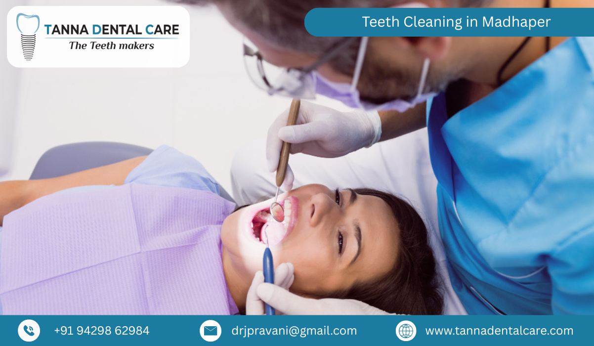 Teeth Cleaning in Madhaper