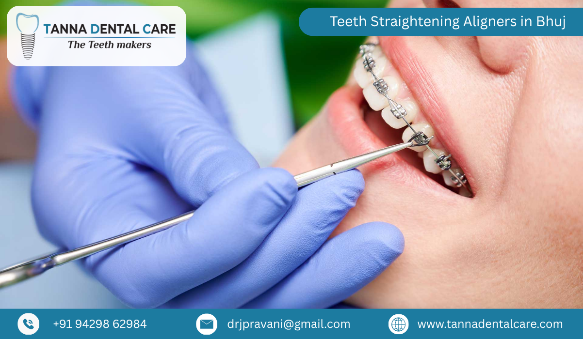 Teeth Straightening Aligners in Bhuj