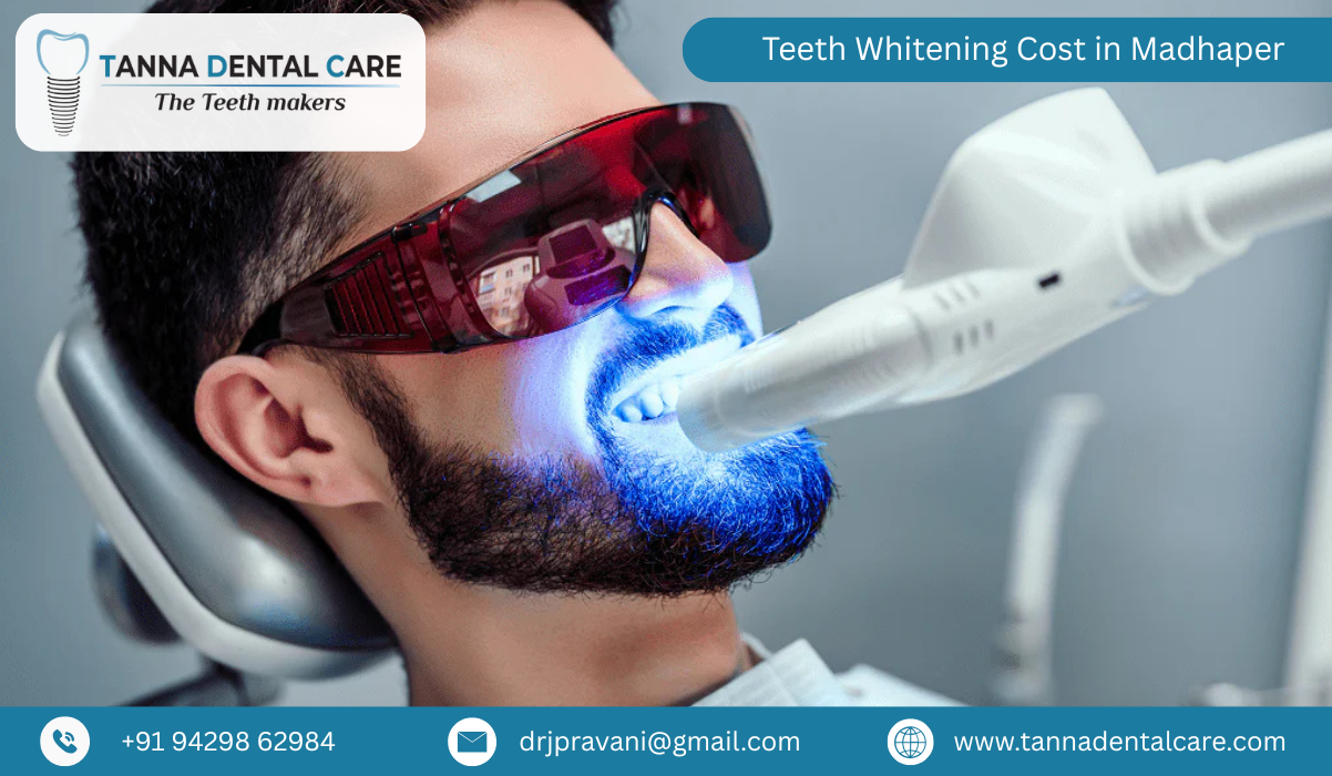 Teeth Whitening Cost in Madhaper