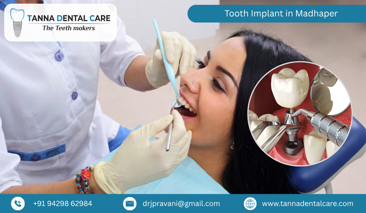 Tooth Implant in Madhaper